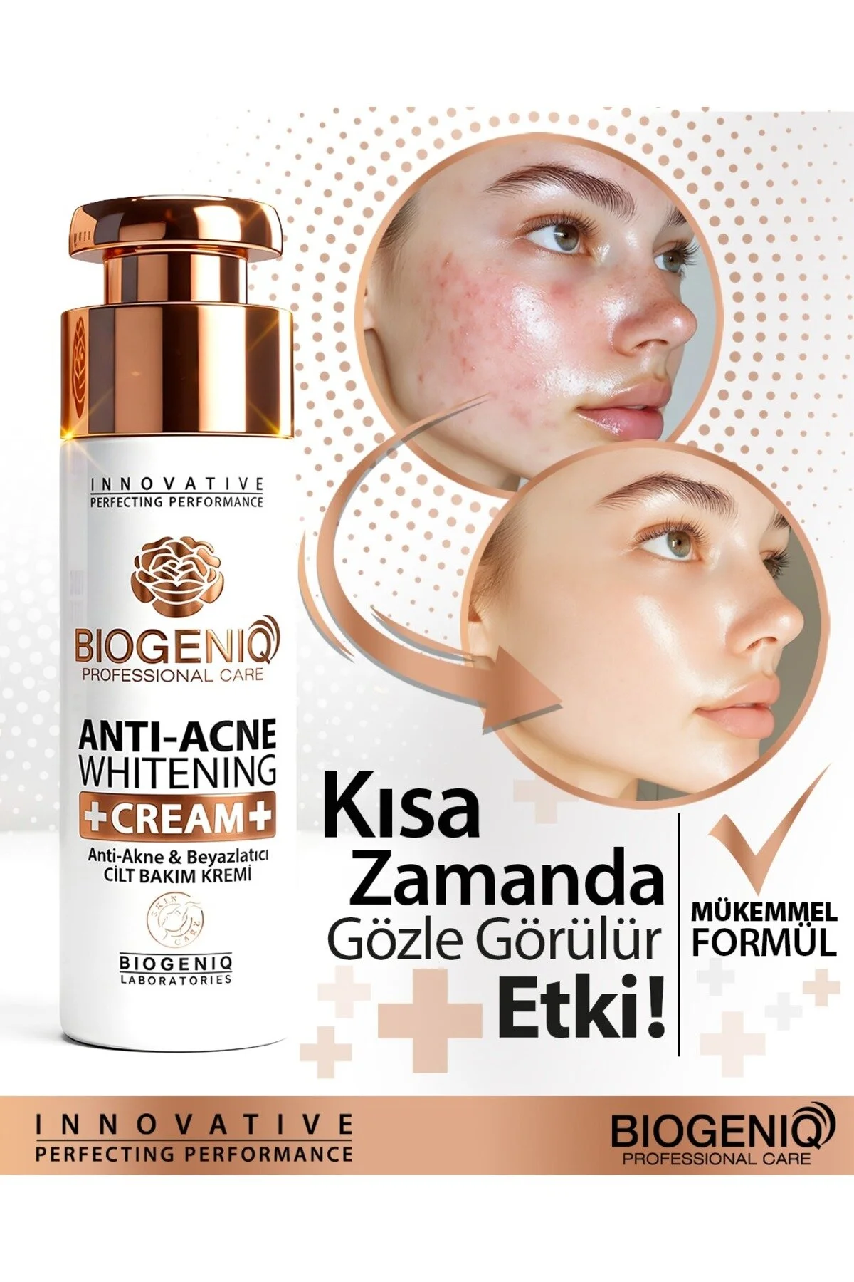 Anti-Akne Temizleyici & Beyazlatıcı Cilt Bakım Kremi